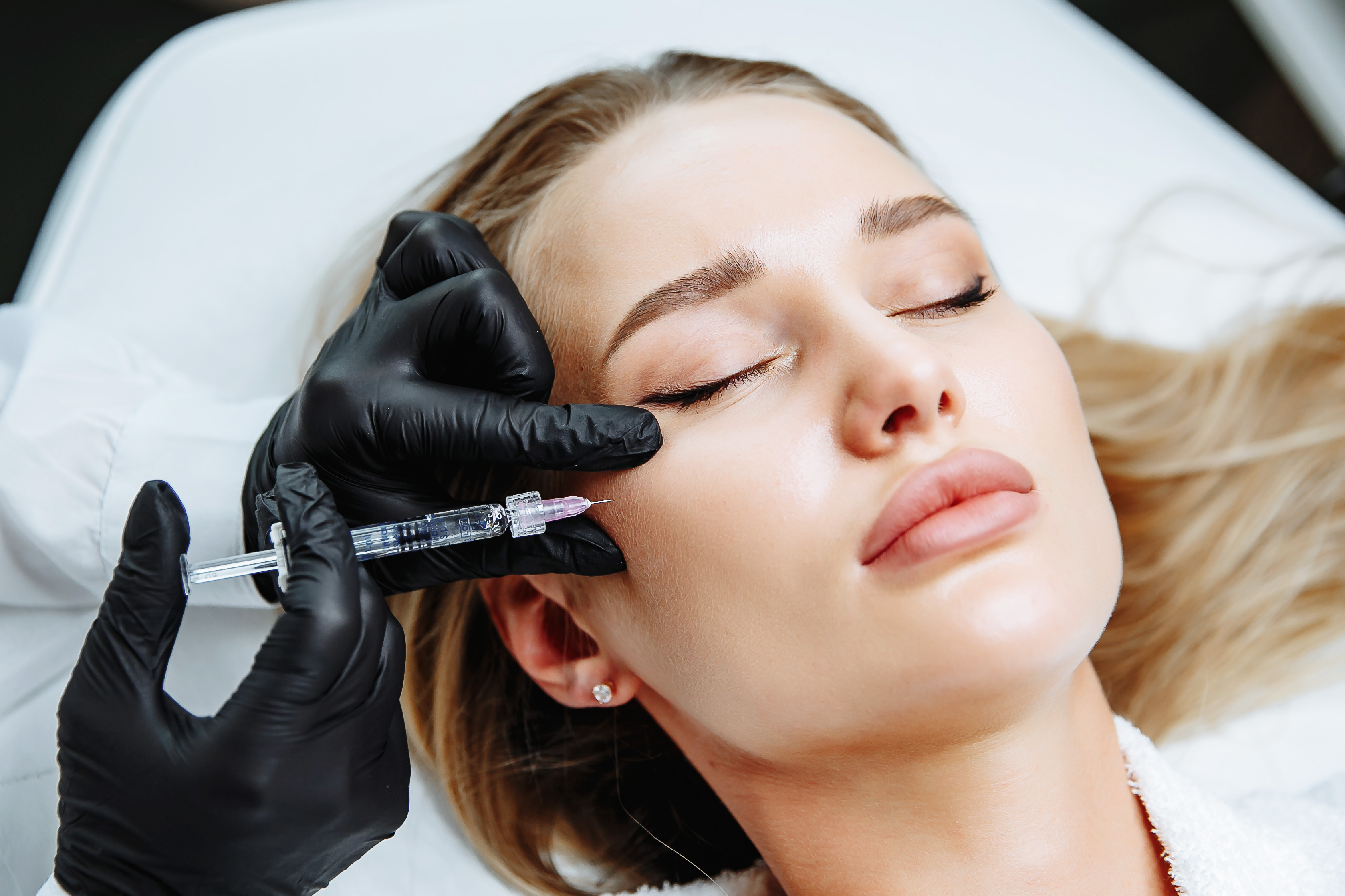 A confident woman with naturally defined, plump cheeks, highlighting the rejuvenating effects of cheek dermal fillers at Serenity MedSpa for a youthful and balanced facial appearance.