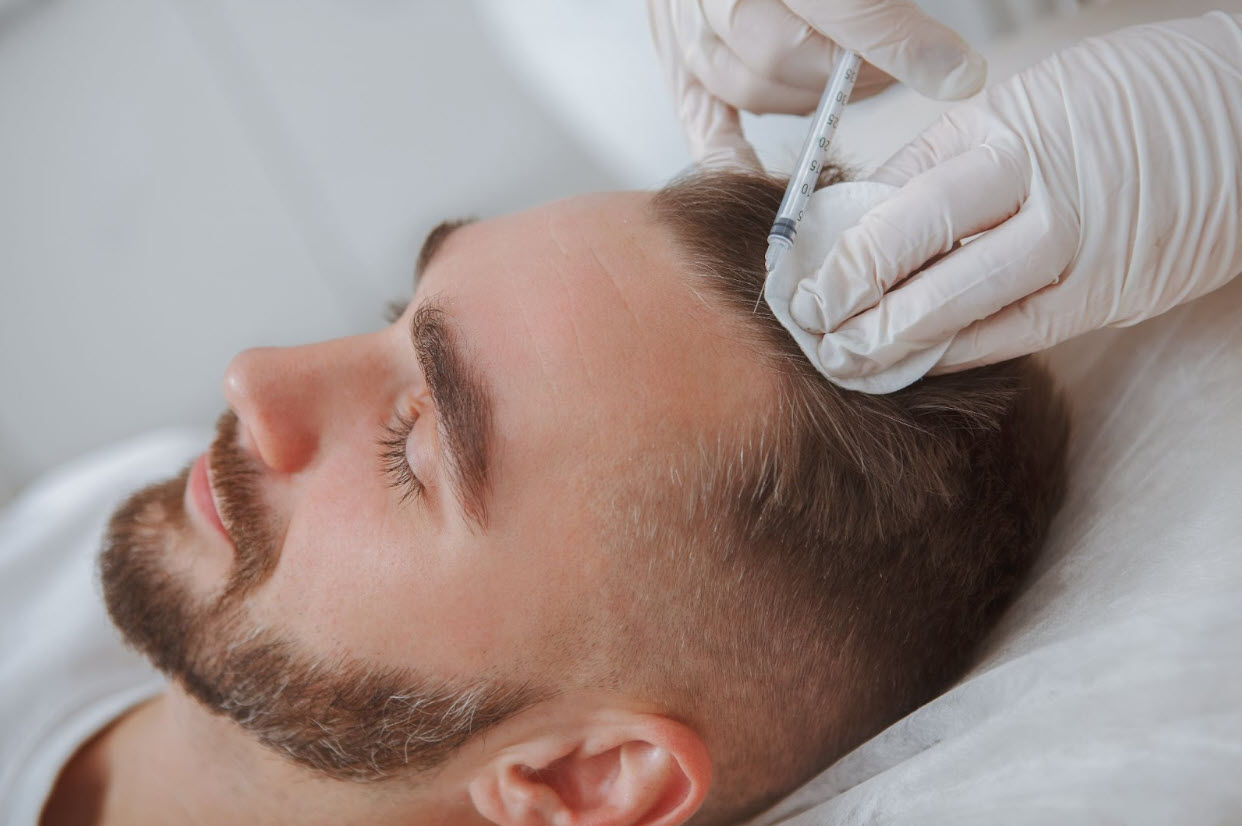 A man undergoing PRP hair treatment with a professional injecting platelet-rich plasma into his scalp to achieve optimal PRP hair treatment results.