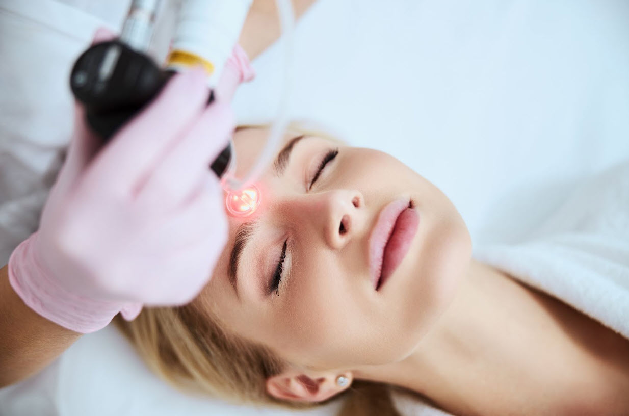 A woman with fair skin receives a laser skin resurfacing treatment on her forehead at a professional clinic, helping to improve skin tone, texture, and collagen production.