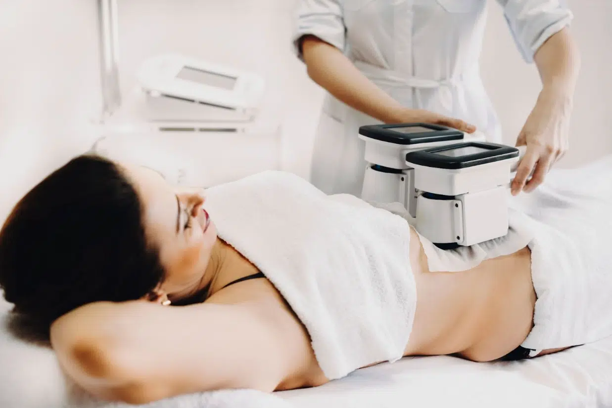 A woman undergoing a CoolSculpting treatment on her abdomen using cryolipolysis applicators at a medspa.